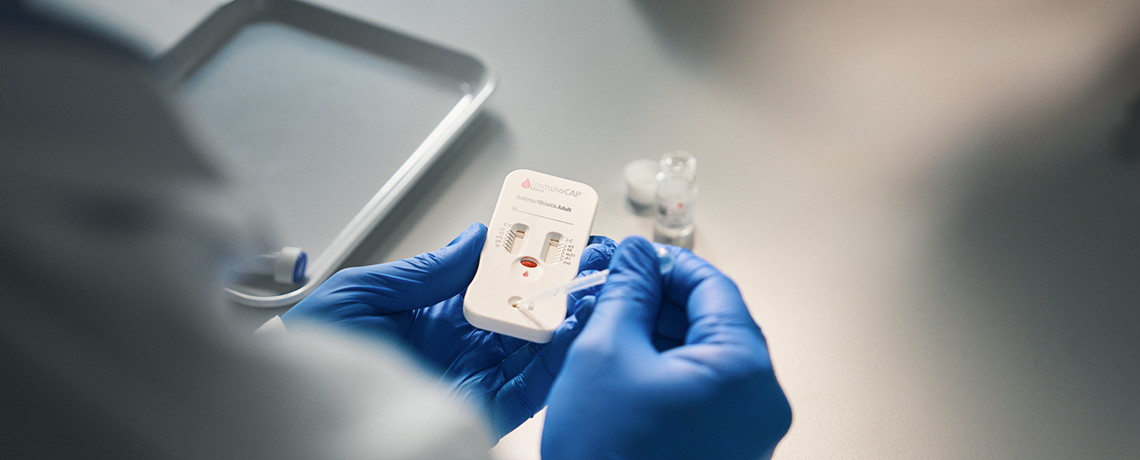 Allergie_Check_Sun_Store_Apotheke