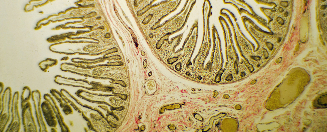 Microbiome_allergie_au_pollen_réguler_Sun_Store_Pharmacie