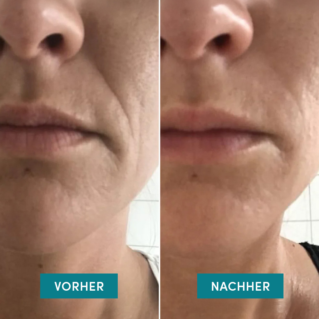 Apricot Mund Patches, Bild 4 von 5