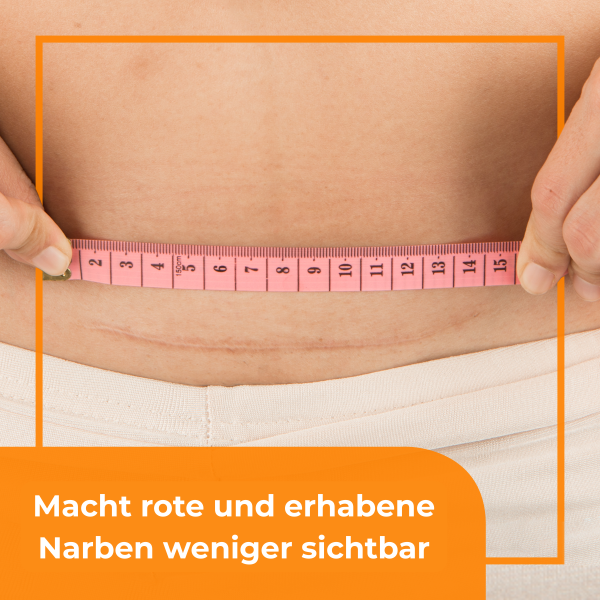 BEPANTHEN DERMA Narben-Gel, Bild 3 von 6