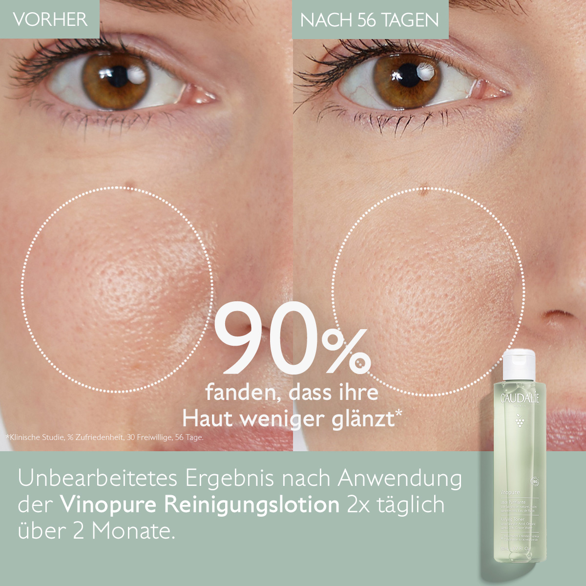 CAUDALIE Vinopure Lotion, image 2 sur 5