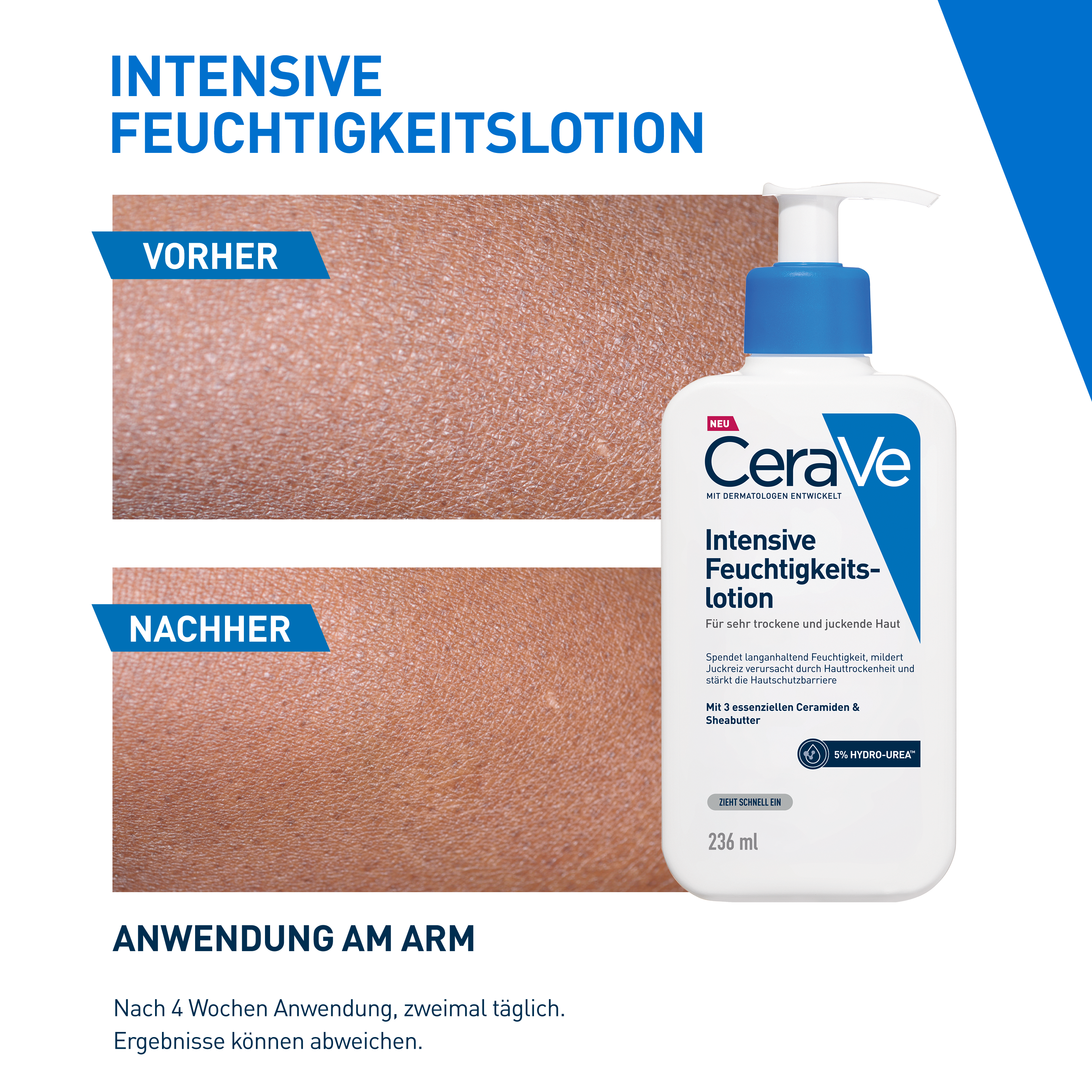 CERAVE Intensive Feuchtigkeitslotion, Bild 3 von 5