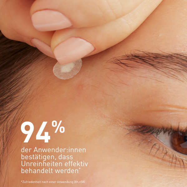 CERAVE Patches Anti-Imperfections, image 4 sur 5