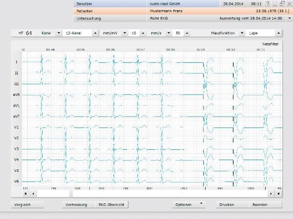 CUSTO MED custo cardio professional Software