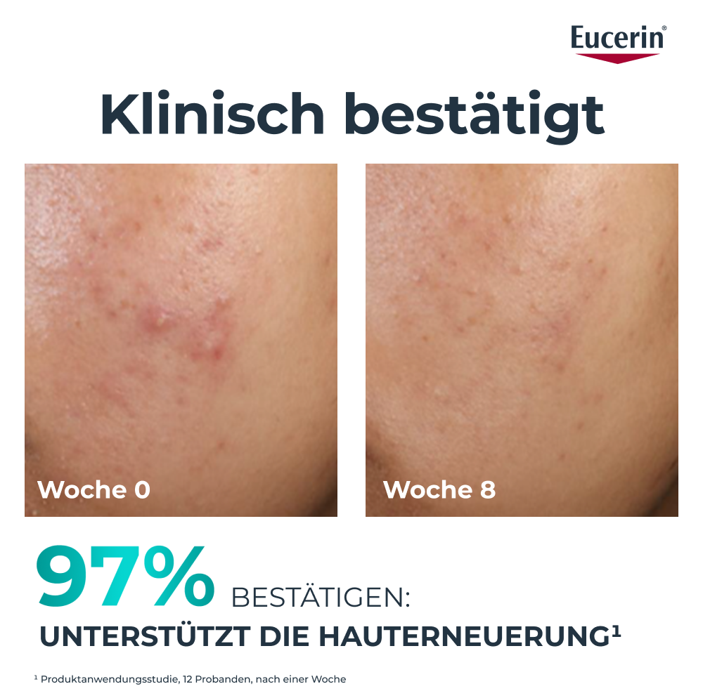 EUCERIN Dermopure Clinical peeling 10 soin de nuit, image 4 sur 5