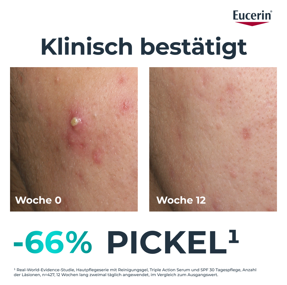EUCERIN Dermopure Clinical Pflege, Bild 4 von 5