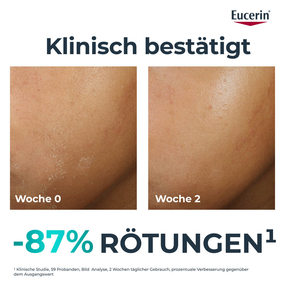 EUCERIN Dermopure Clinical soin hydratant, image 3 sur 5