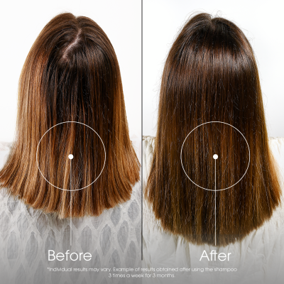 Klorane Haarausfall Shampoo, Bild 4 von 6