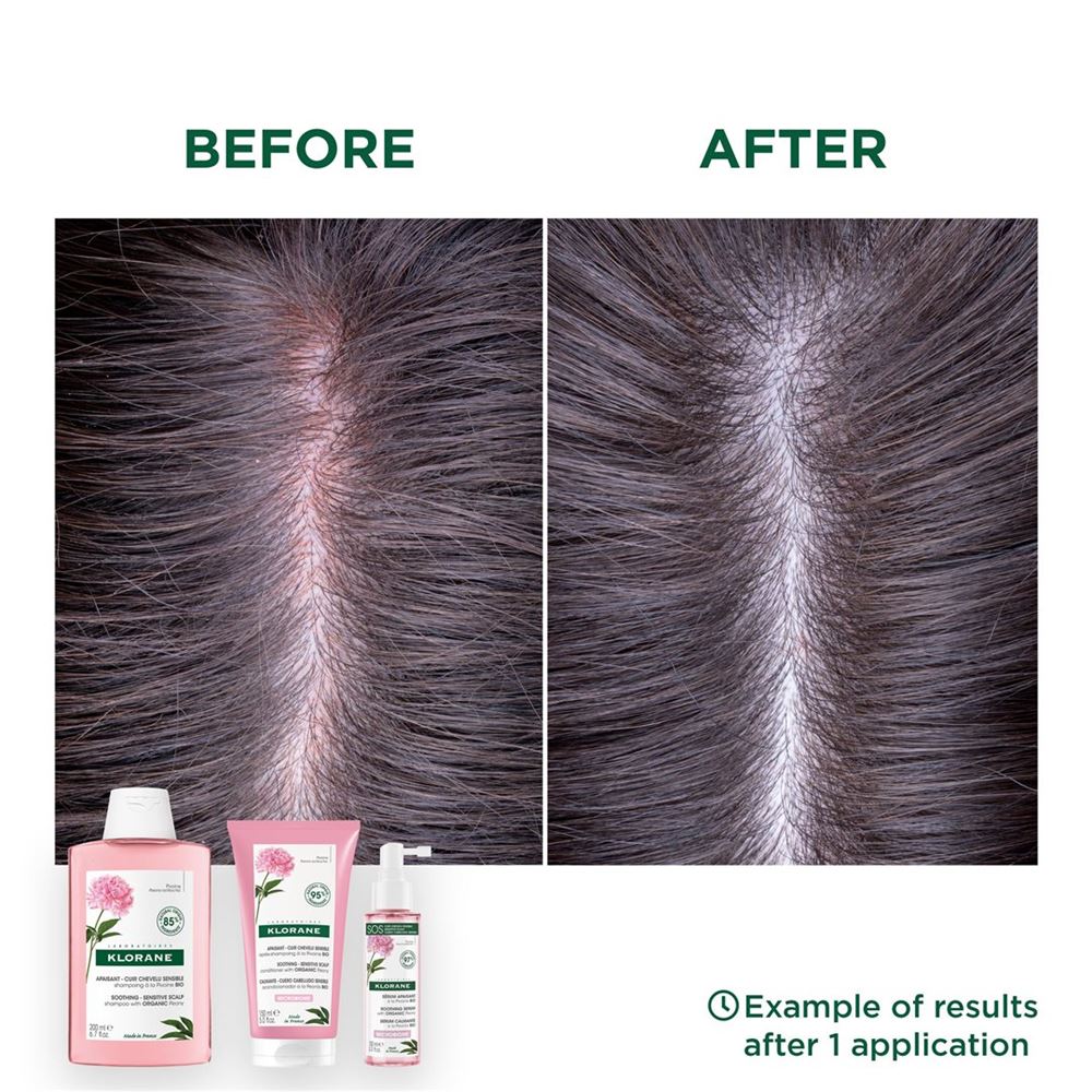 Klorane Serum
