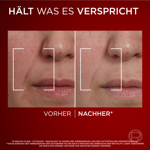 L'Oréal Paris Maquillage Revitalift Laser X3 Dreifach-Power Anti-Age, Bild 5 von 5