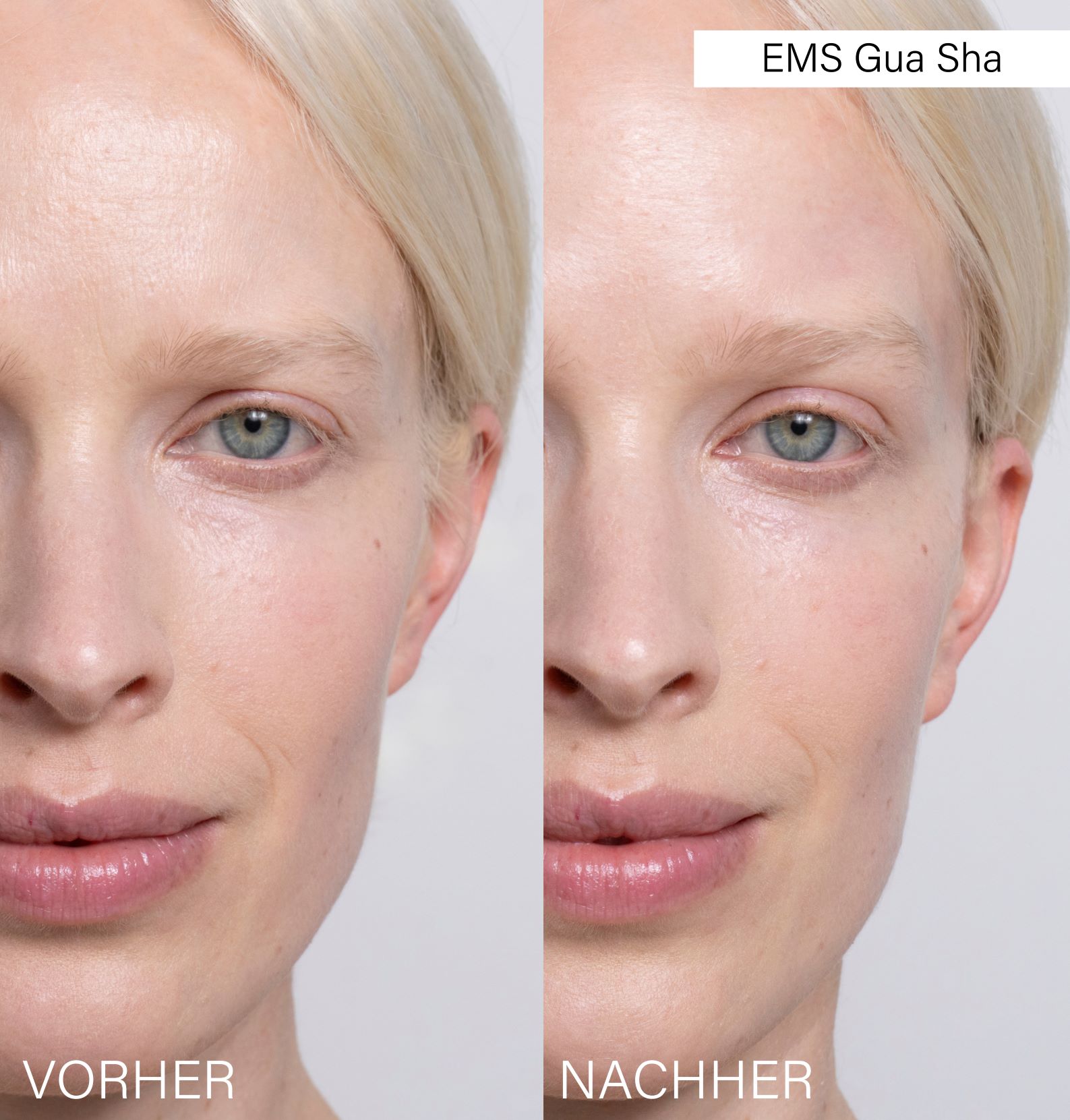 ROSENTAL ems gua sha, image 4 sur 5