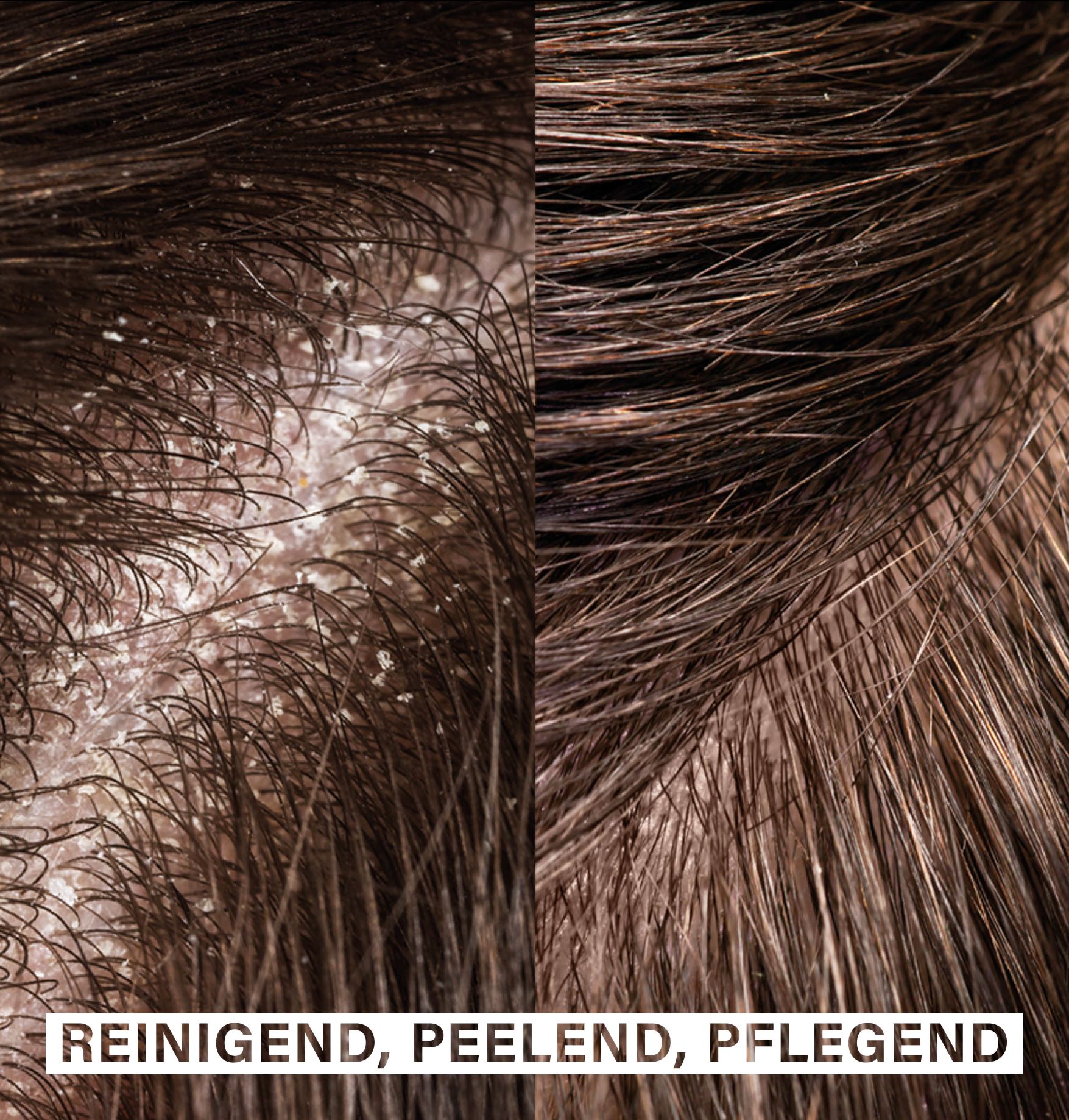 ROSENTAL exfoliating hair brush, image 3 sur 5