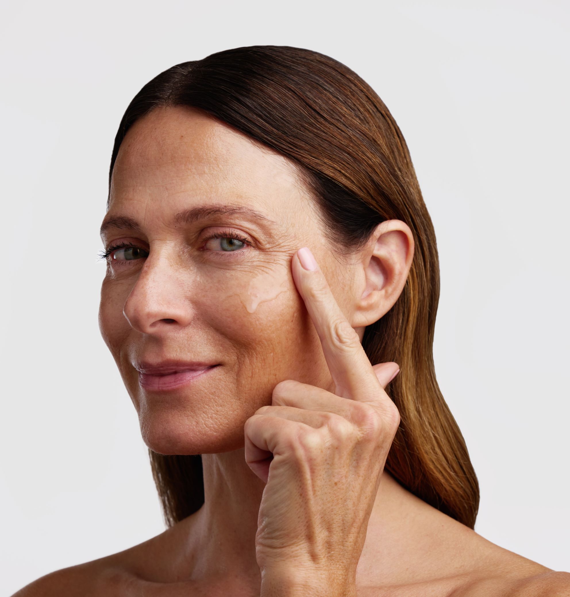 ROSENTAL Microneedling Effect Treatment, Bild 2 von 5