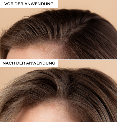 ROSENTAL Natural Dry Shampoo, Bild 4 von 5