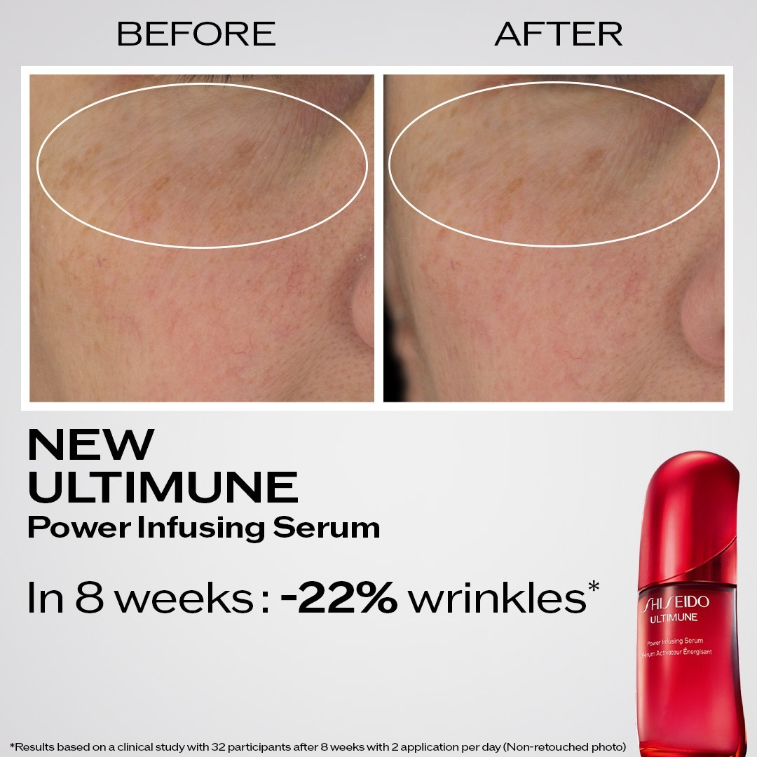 Shiseido Ultimune Power Infusing Serum, image 4 sur 5