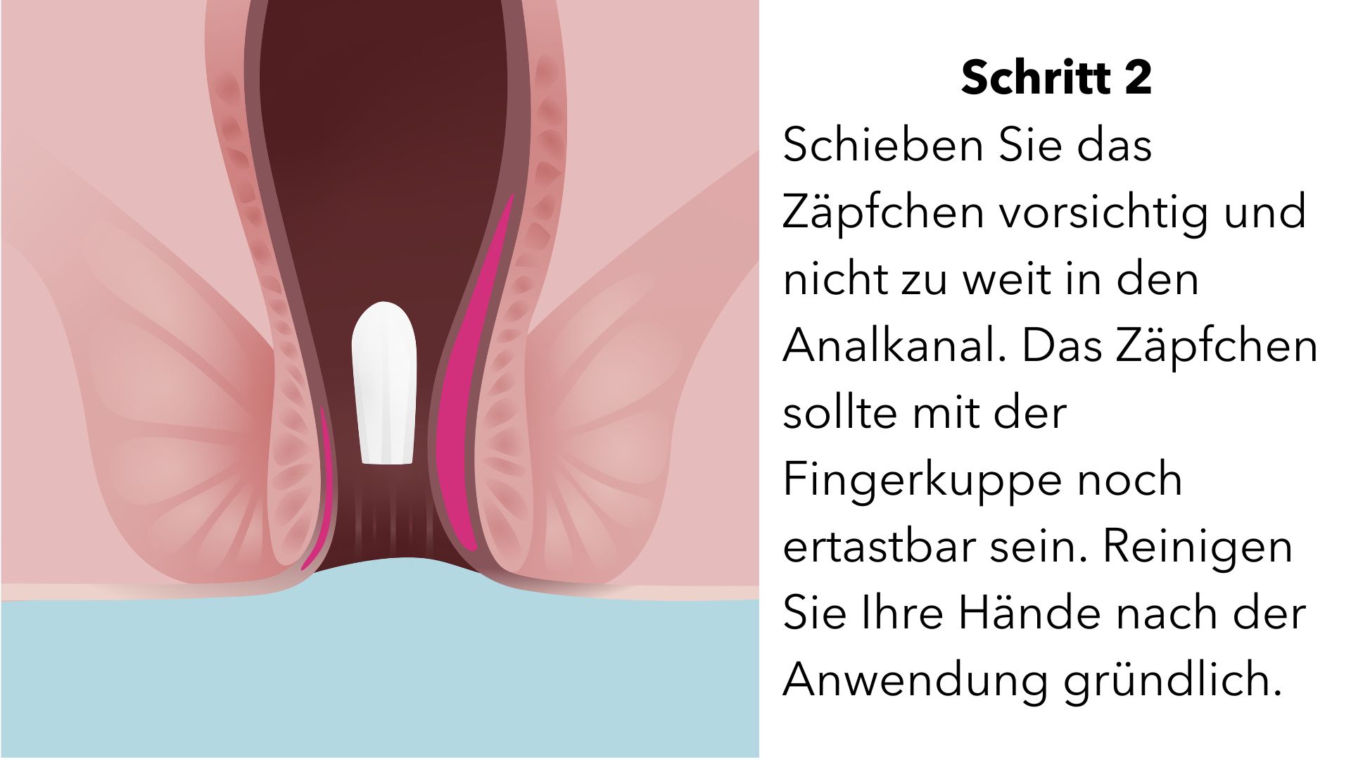 SULGAN Supp 20 Stk, Bild 3 von 4